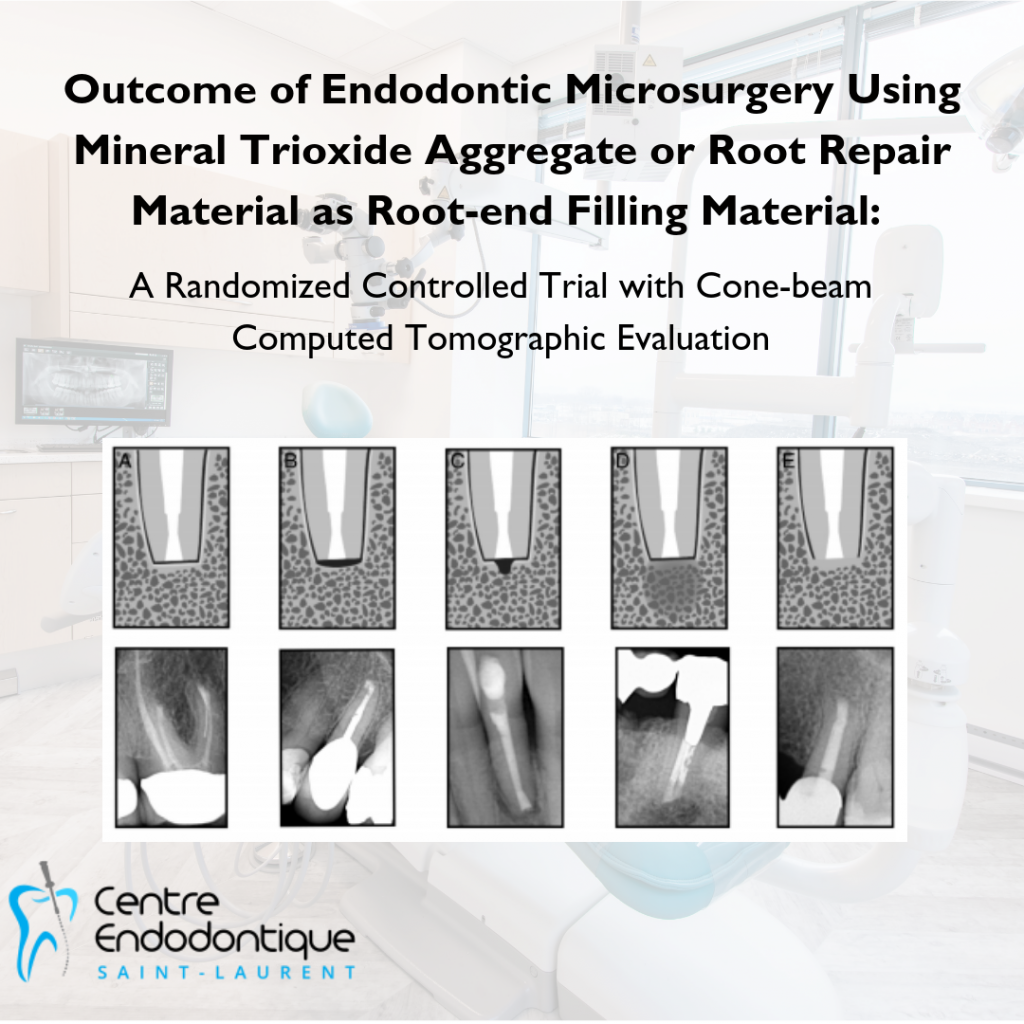 of Endodontic Microsurgery Using Mineral Trioxide Aggregate or